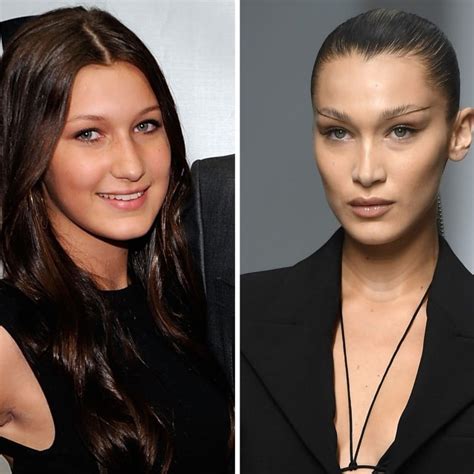 How to Get Bella Hadid’s Face: Fillers & Buccal Fat。